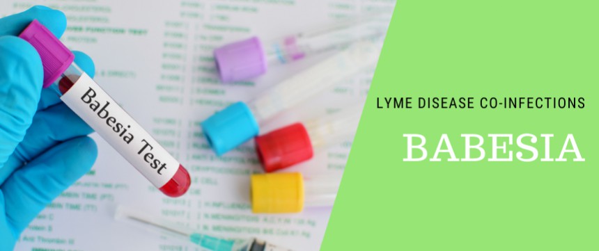 Lyme disease co-infections - Babesia